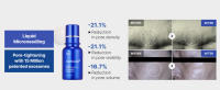 microneedle, Zero exosome shot, Lacto exosome, instant pore-tightening care, Pore Refining serum