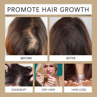 Esencia para el cuero cabelludo en aerosol hidratante, suave y esponjoso para el cuidado del cabello - details 6