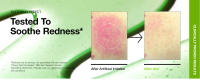 Anua Azelaica Acida Suero Reductor de Rojos de Hialurónico 10 Cuidado de Manchas de Piel Sensible - details 2