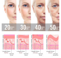 Máquina Facial de alta frecuencia, varita de electroterapia, tubo de vidrio, elimina arrugas, acné, herramienta para el cabello - details 9