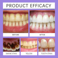 Pasta de dientes de belleza púrpura blanca brillante, limpieza bucal suave, aliento fresco, cuidado de los dientes limpios - details 9