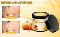 Bee Venom Treatment Cream