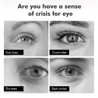 Máquina de Masaje para Belleza de Ojos con Luz Roja Terapia Herramienta de Cuidado con Vibraciones Tratamiento de Salón Compresión de Calor Dispositivo para Piel Normal - details 2