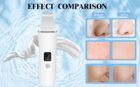 Depurador de piel, espátula ultrasónica para eliminar puntos negros con 4 modos, limpiador de poros faciales recargable por USB, extractor de comedones, eliminador de arrugas, herramientas para el cuidado de la piel para limpieza facial profunda - details 2