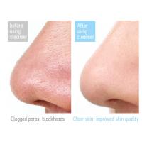 Cepillo Facial de Silicona Eléctrico Recargable por USB, Impermeable, Limpieza Profunda, Exfoliación y Masaje, Adecuado para Piel Sensible Herramienta de Cuidado de la Piel de Belleza - details 6