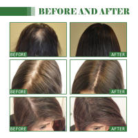 El crecimiento nutre y suaviza el cabello, repara las raíces, fortalece el cuidado, aceite esencial para el cabello Batana - details 8