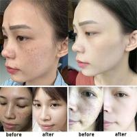 Crema Blanqueadora Efectiva para Manchas Negras Anti-Manchas, Desvanecimiento de Pigmentación, Iluminación del Piel Herramienta de Cuidado de la Piel Corporal de Belleza - details 9
