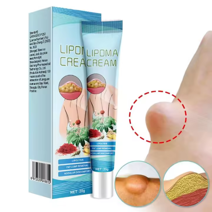 Crema para el cuidado del cuerpo, 20g, loción para el cuidado del lipoma, crema para la piel, ungüento linfático antihinchazón multifuncional, crema de eliminación de celulitis segura - 1