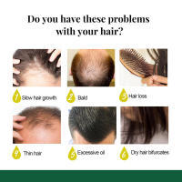 Spray de jengibre, masaje más fuerte, reparación del cuero cabelludo, líquido para el cuidado del cabello - details 4