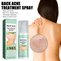Spray reparador de acné en la espalda, aceite esencial para eliminación de acné, tratamiento de acné, Spray que se desvanece, marcas de acné, crema para el cuidado de la piel para todo tipo de piel, 120ml - details 0