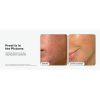 Paula's Choice SKIN PERFECTING 2% BHA Exfoliante líquido de ácido salicílico-exfoliante facial para puntos negros, poros agrandados y arrugas - details 3