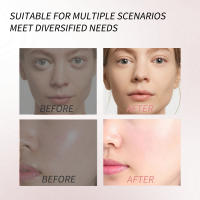 Crema de Gelatina de Colágeno Micro-agujas Faciales para Reducir Poros, Eliminar Comedones, Nourutar Piel Suave Herramientas de Cuidado de la Piel Facial - details 8