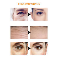 Mascarillas de Ojos de Colágeno 10Pcs para Eliminar Ojeras, Reafirmar Piel, Hidratar - details 7