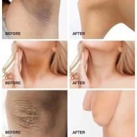 Crema Blanqueadora Effectiva para Piel Oscura Nicotinamida Melanina Cuidado de la Piel Corporal - details 8