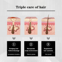 El spray antipérdida mejora la densidad de la línea del cabello, fortalece el cabello, nutre el cuero cabelludo e hidrata el cabello. - details 7