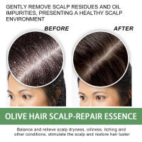 Cuidado de la oliva que alivia el enrojecimiento del cuero cabelludo, repara los folículos de acné, la picazón y la esencia para cabello apretado. - details 5