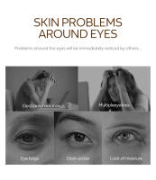 Máscara de ojos de caracol dorada, hidrata y nutre la piel del contorno de los ojos en profundidad. Reducir las ojeras,50 Piezas - details 1