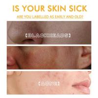 Mascarilla de Honey Natural Rejuvenecedora, Ligera Taches Dark, Reduce Poros - details 3
