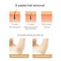 Depiladora láser IPL para mujeres, máquina de depilación láser portátil, permanente, indolora, dispositivo de uso doméstico - details 5