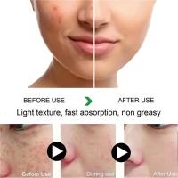 Crema Blanqueadora Efectiva para Manchas Negras Anti-Manchas, Desvanecimiento de Pigmentación, Iluminación del Piel Herramienta de Cuidado de la Piel Corporal de Belleza - details 8