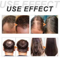 El aceite esencial de cuidado hidrata la raíz, repara el encrespamiento, los nudos, la suavidad, la dureza y el cabello grueso. - details 7