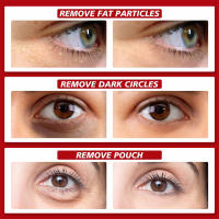 Crema para ojos para eliminar arrugas instantáneas, colágeno, elimina las líneas finas, bolsas para los ojos, antihinchazón, humectante reafirmante, cuidado de los ojos - details 0
