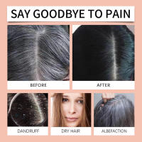 El aceite esencial HOEGOA Care nutre el cabello seco y encrespado. - details 8