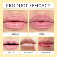 Bálsamo labial oscuro para eliminar la melanina, mascarilla iluminadora, aceite brillante, exfoliante, hidratante limpio, cuidado coreano, maquillaje, productos de belleza y salud - details 12