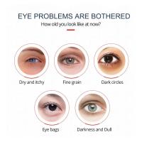 Crema Antiedad para Ojos con Retinol Reduce Arrugas, Elimina Bolsas, Reafirma Piel - details 1