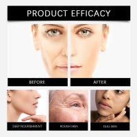 Nicotinamida Hidrata en el rostro, rejuvenece y revitaliza la crema facial para el cuidado diario de la piel. - details 8