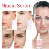 Sérum Facial Coreano Niacinamida Ilumina la Piel, Rejuvenece, Hidrata, Blanquea, Desvanece Manchas y Líneas Finas Herramienta de Cuidado de la Piel de Belleza - details 15