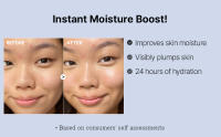Thehyaluronic_c0