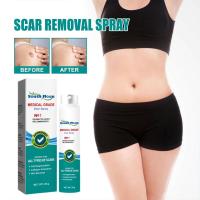 Spray para eliminar cicatrices, cuidado de cicatrices, Reduce la formación de cicatrices, cicatrices que se desvanecen, cicatrices de acné, cicatrices quirúrgicas y estrías, Spray para eliminar cicatrices - details 5