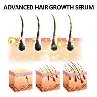 Loción de esencia para el cuidado del cabello hidrata el cabello, fácil de absorber, fuerte, flexible, cuidado del cabello, aceite esencial para el cuidado del cuero cabelludo - details 7