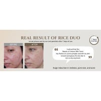 rice MASK
