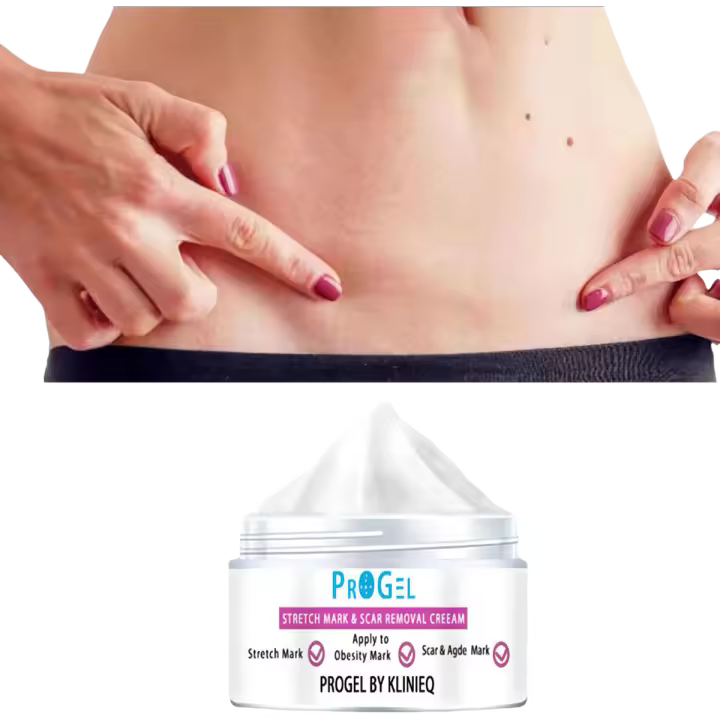 Crema para cicatrices aclara las estrías, los bultos de grasa y las cicatrices, hidratando la piel. - 1