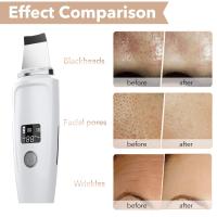 Exfoliante de Piel Ultrasónico Herramienta de Limpieza Facial Profunda con Pantalla LCD - details 6