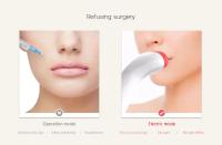 Dispositivo de silicona para Plumper de labios, herramienta de belleza eléctrica para mujer, más grande y grueso - details 2