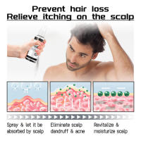 El spray antipérdida mejora la densidad de la línea del cabello, fortalece el cabello, nutre el cuero cabelludo e hidrata el cabello. - details 6