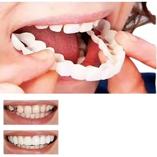 4Pcs/Set Natural Cosmetic Fake Tooth, Adult Perfect Smile Whitening Denture Fit Flex Cosmetic Teeth Comfortable Veneer Cover Den - 1