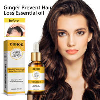 Ginger Care Raíces suaves, nutritivas e hidratantes, nutritivo, cuidado del cabello, aceite esencial para masaje del cuero cabelludo - details 1