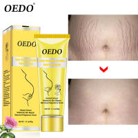 Crema para eliminar estrías de rosas, crema para eliminar la obesidad posparto, crema corporal reafirmante antienvejecimiento para mujeres embarazadas - details 7