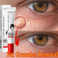 Crema para los Ojos Removedor de Granulos de Grasa Mejora la Firmeza y Iluminación - details 1