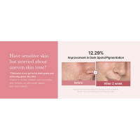 medicube I Tónico Pink Glow para estimular, calmar y calmar, tono desigual, péptido PDRN de rosa y niacinamida, cuidado de la piel coreano - details 2