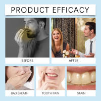 El coco oral refresca el aliento, limpia los olores, las manchas, la suciedad y embellece los dientes con aceite de enjuague bucal. - details 6