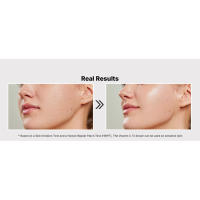 skin irritation test real results used on all skin types sensitive skin hript clinically tested