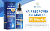 5% Minoxidil