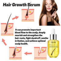 Previene la caída, nutre el cabello, cuidado del cuero cabelludo, esencia densa para el cuidado del cabello - details 4