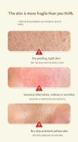 Crema Blanqueadora Astragalus Removedor de Manchas Dark Eyes Reparador de Melasma Hidratante - details 3