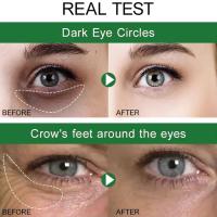 Crema de Ojos para Bujías Instantáneas Reducción de Arrugas, Desvanezimiento de Hinchazón, Reafirmación de Piel Blanca Bajo los Ojos Herramientas de Cuidado de la Piel Facial - details 2